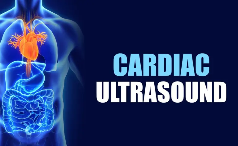 Cardiac ultrasound